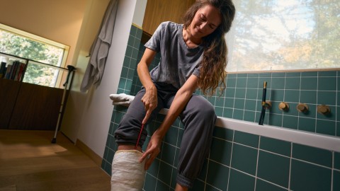 Foto vrouw met gips
